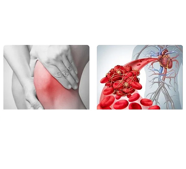 世界關(guān)節(jié)炎日&世界血栓日 | 四大招式降低患病風(fēng)險(xiǎn)，守護(hù)生命健康！